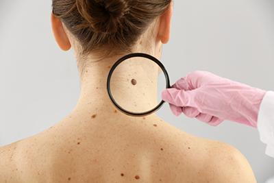magnifying glass checking neck and back spots